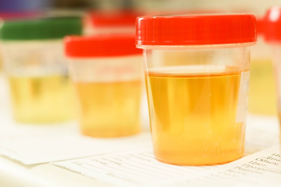 La importancia del color de la orina en la salud
